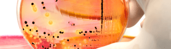 formation,formation laboratoire,microbiologie,agroalimentaire,Analyses microbiologiques
